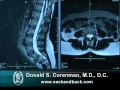 How to Read a MRI of the Normal Lumbar Spine | Lower-Back | Vail Spine Specialist