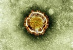 This undated image released by the British Health Protection Agency shows an electron microscope image of a coronavirus, part of a family of viruses that cause ailments including the common cold and SARS, which was first identified last year in the Middle East.