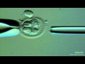 著床前基因診斷．胚葉切片 (blastomere biopsy)