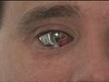 Man sees with 'bionic eye'