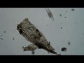 Bdelloid Rotifers Recorded with Canon T1i