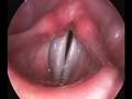 Vocal Folds