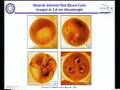 AST 210/EE 213 - Lecture 27: Applications of zone plate...