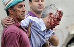 In this photo taken on Wednesday July 24 2013, train driver Francisco Jose Garzon Amo is helped by two men as he is evacuated from the site of a train accident in Santiago de Compostela, Spain.