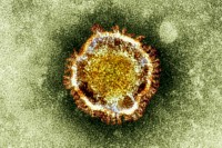 
Auch für die Seuche Sars verantwortlich: das neue Corona-Virus. Die kleinen kranzartigen Strukturen an der Oberfläche der Virenhülle geben ihm den Namen 
