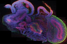 
Auf dem Schnittbild des Minihirns kann man verschiedene Gehirnregionen erkennen. In diesem Ausschnitt sind alle Gehirnzellen blau, alle neuronal Stammzellen rot und alle Neuronen grün markiert 
