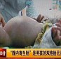 Surgery: The two-year-old boy had his parasitic twin removed from his stomach in a rare case of cryptodidymus or conjoined twins 