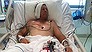 Barry Lynch, who blew a hole in his leg while trapped under the weight of a tanker in north Queensland