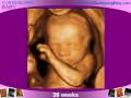 Watch the Baby Grow! Ultrasounds Week by Week During Pregnancy