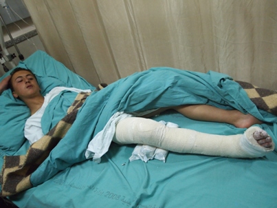 13 year-old boy shot and beaten by settlers, leg broken