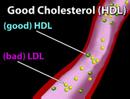 Understanding Cholesterol (Cholesterol #1)