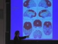 Lecture 06: Architecture of Cortex & Going Beyond Primary Visual Cortex