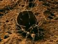 The Unknown Micro World : Dust Mites