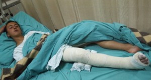 13 year-old boy shot and beaten by settlers, leg broken