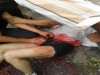Imagen de uno de los heridos a bala en Castilla, municipio de Coyaima (Tolima)