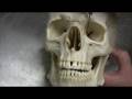 Dr. Fabian Identifying Parts of the Skull Part 1 of 2