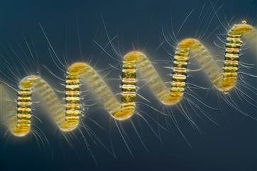 Mr. Wim van Egmond
Micropolitan Museum
Berkel en Rodenrijs, Zuid Holland, The Netherlands
Chaetoceros debilis (marine diatom), a colonial plankton org...