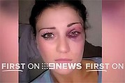 A girl who alleges she was beaten by three NRL stars