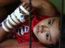 Image: A young girl lies in a bed awaiting treatment in Tacloban Hospital