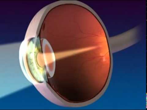 Anatomy and Function of the Eye