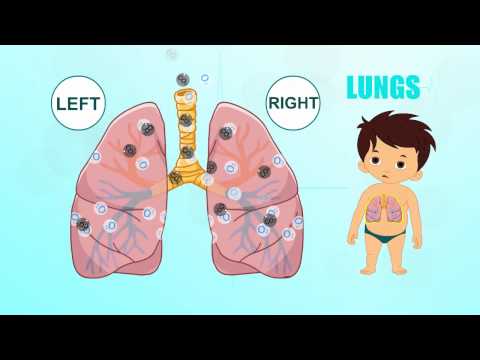 Learn about Human Body Parts For Kids - LUNGS