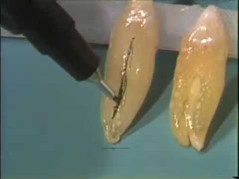 Dental Anatomy: The Canine Teeth