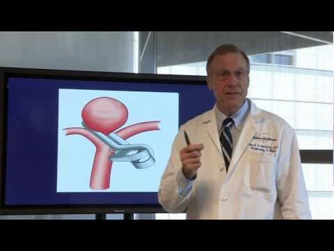 Unruptured Aneurysms: When and How to Treat | Dr. Neil Martin - UCLA Neurosurgery