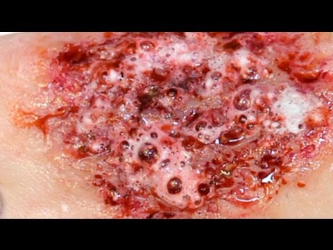 FX Makeup Series: Acid Burns