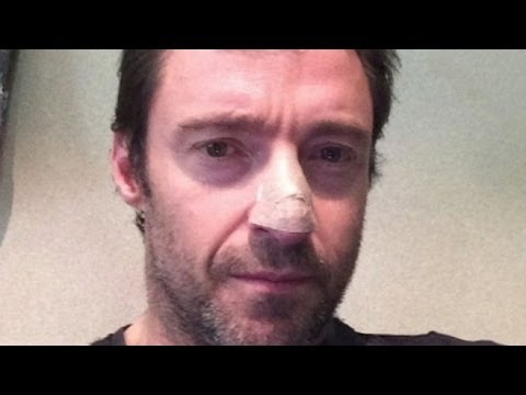 Hugh Jackman Reveals Skin Cancer Diagnosis