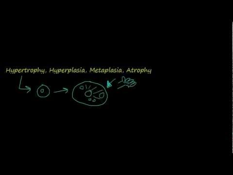 #2 - Introduction to pathology - hypertrophy, hyperplasia