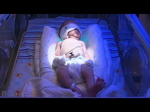 Drug-Dependent Infants Detox at Tenn. NICU