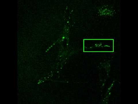 alpha-adrenergic receptors in cardiac myocytes