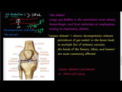 #62P - Air Embolism, decompression sickness, the bends, the chokes, cassion disease