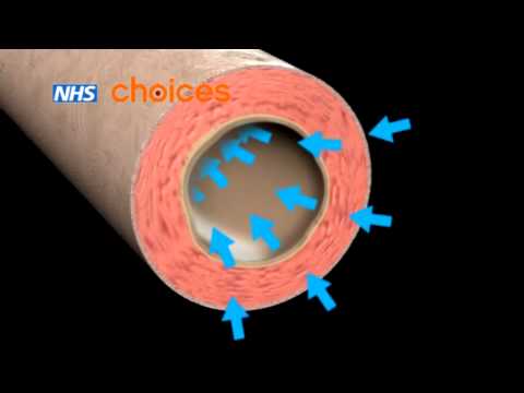 Asthma: an animation