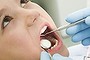Close-up of little boy opening his mouth during dental checkup Tug