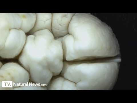 Teeth destroyed by phosphoric acid in sodas - shocking microscopic video