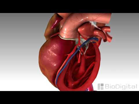 3D Medical Animation - Congestive Heart Failure