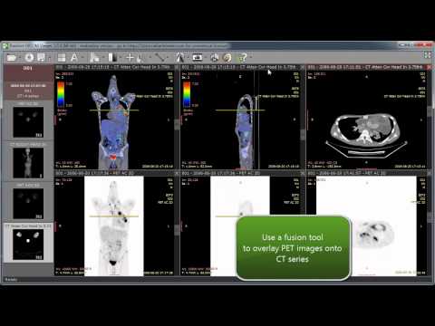 RadiAnt DICOM Viewer 1.0.4 - new features - http://www.radiantviewer.com