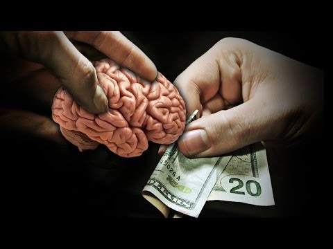 Brains Sold on Ebay!