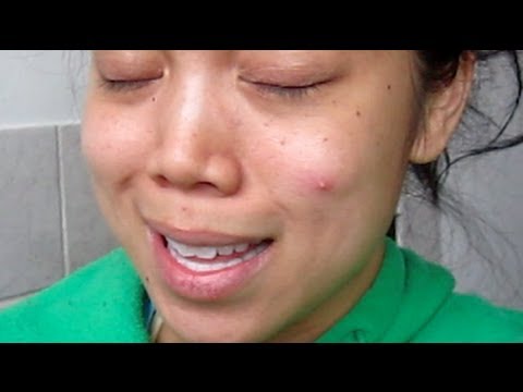 The Zit - April 25, 2012 - itsJudysLife Vlog