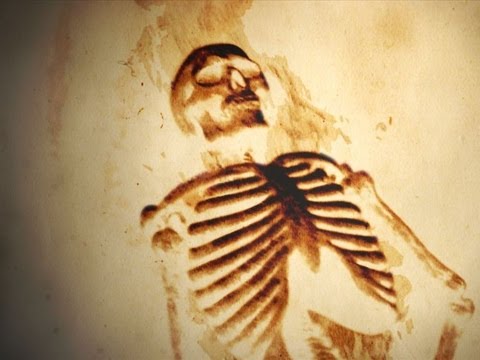 10 Unexplained Medical Conditions