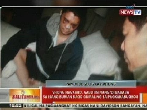 BT: Vhong Navarro, aabutin nang 'di bababa sa 1 buwan bago gumaling