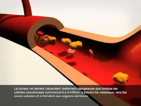 Le cancer : de la cellule saine à la cellule malade