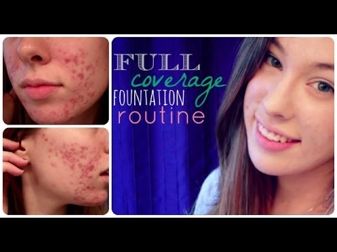 How I Cover My Acne // Full Coverage Foundation Routine [Winter 2013]