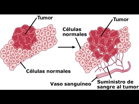 CANCER: ¿HABRÁ CURA?