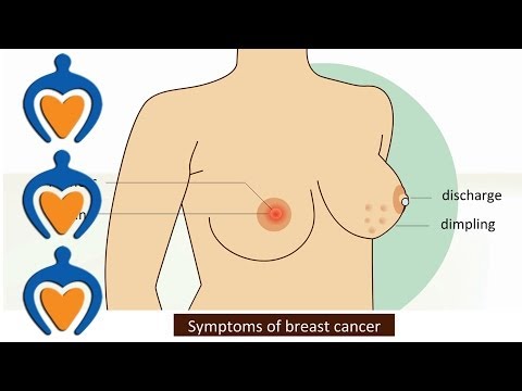 Breast cancer - Symptoms and treatment