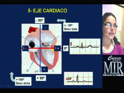 Como interpretar un ECG. Curso Intensivo MIR Asturias