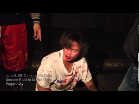 Bloody Brawl at Session Road, Baguio City