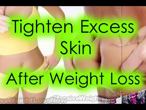 How to Tighten Excess Skin After Weight Loss