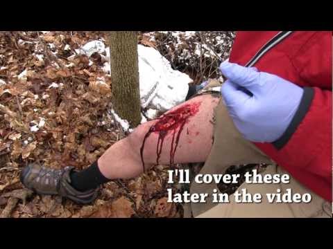 Field Wound Care - Tips for surviving a severe wounds away from medical care